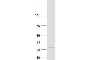 Validation with Western Blot (MAX Protein (Transcript Variant 2) (Myc-DYKDDDDK Tag))