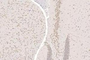 Immunohistochemistry (Paraffin-embedded Sections) (IHC (p)) image for anti-T-Box 19 (TBX19) antibody (ABIN7075815)