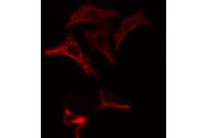 ABIN6274865 staining Hela cells by IF/ICC. (Arylsulfatase A Antikörper  (Internal Region))