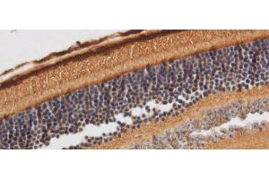 Immunohistochemistry of paraffin-embedded Rat retina using RBP3 Polyclonal Antibody at dilution of 1:50 (RBP3 Antikörper)