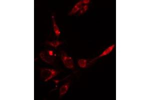 ABIN6266633 staining HepG2 cells by IF/ICC. (INPP5D Antikörper  (C-Term))