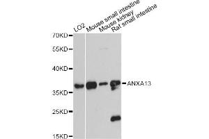 Western blot analysis of extracts of various cell lines, using ANXA13 antibody (ABIN6290067) at 1:3000 dilution. (Annexin A13 Antikörper)