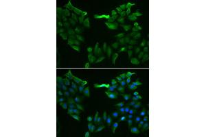 Immunofluorescence analysis of HeLa cell using SLC5A6 antibody. (SLC5A6 Antikörper)