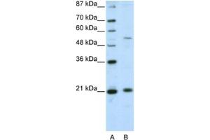 Western Blotting (WB) image for anti-Zinc Finger and SCAN Domain Containing 20 (ZSCAN20) antibody (ABIN2461978) (ZSCAN20 Antikörper)