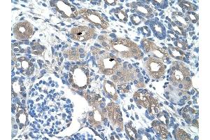 RSAD2 antibody was used for immunohistochemistry at a concentration of 4-8 ug/ml to stain Epithelial cells of renal tubule (arrows) in Human Kidney. (RSAD2 Antikörper  (C-Term))