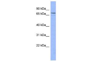 WB Suggested Anti-PATZ1  Antibody Titration: 0. (PATZ1 Antikörper  (N-Term))