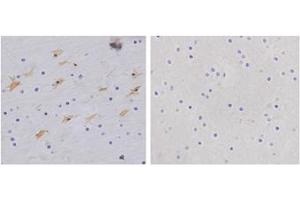 Immunohistochemistry analysis of human brain tissue slide (Paraffin embedded) using Rabbit Anti-GFAP Polyclonal Antibody (Left, ABIN398827) and Purified Rabbit IgG (Whole molecule) Control (Right, ABIN398653) (GFAP Antikörper  (AA 250-300))