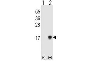 Western blot testing of SUMO2/3 antibody and 293T cell lysate either nontransfected (Lane 1) or transiently transfected (Lane 2) with the SUMO3 gene. (SUMO2/3 Antikörper  (AA 49-81))