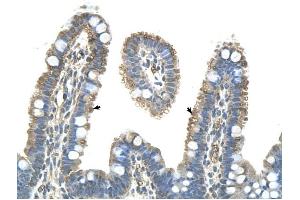 Pannexin 1 antibody was used for immunohistochemistry at a concentration of 4-8 ug/ml to stain Epithelial cells of intestinal villus (arrows) in Human Intestine.