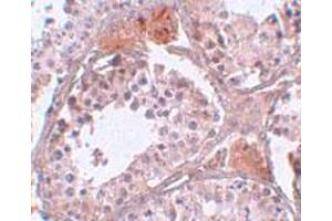 Immunohistochemical staining of human testis tissue with 5 ug/mL C4 or f35 polyclonal antibody . (CABS1 Antikörper  (C-Term))