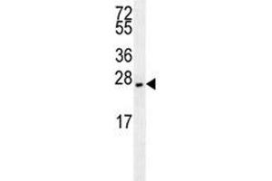 EIF4E2 antibody western blot analysis in NCI-H460 lysate. (EIF4E2 Antikörper)