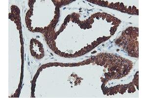 Immunohistochemical staining of paraffin-embedded Human breast tissue using anti-C20orf3 mouse monoclonal antibody. (APMAP Antikörper)