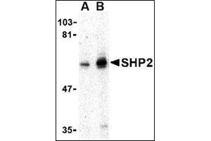 Western blot analysis of SHP2 in mouse skeletal muscle tissue lysate with this product at (A) 0. (PTPN11 Antikörper  (N-Term))