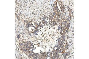 IHC analysis of SNPH using anti-SNPH antibody (ABIN7601724). (Syntaphilin Antikörper  (AA 43-482))