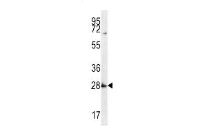 SYPL1 Antibody (N-term) (ABIN656672 and ABIN2845911) western blot analysis in MDA-M cell line lysates (35 μg/lane). (SYPL1 Antikörper  (N-Term))