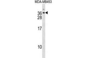 Western blot analysis in MDA-MB453 cell line lysates (35ug/lane) using DLX6  Antibody . (DLX6 Antikörper  (Middle Region))