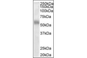 Image no. 1 for anti-Transcription Factor EB (TFEB) (Internal Region) antibody (ABIN374974) (TFEB Antikörper  (Internal Region))