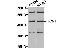 Western blot analysis of extracts of various cell lines, using TCN1 antibody. (TCN1 Antikörper)