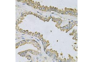 Immunohistochemistry of paraffin-embedded human prostate using APRT Antibody. (APRT Antikörper  (AA 1-180))