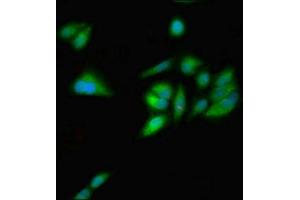 Immunofluorescent analysis of Hela cells using ABIN7154751 at dilution of 1:100 and Alexa Fluor 488-congugated AffiniPure Goat Anti-Rabbit IgG(H+L) (GNL1 Antikörper  (AA 251-500))