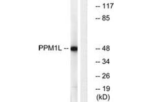 Western Blotting (WB) image for anti-Protein Phosphatase, Mg2+/Mn2+ Dependent, 1L (PPM1L) (AA 119-168) antibody (ABIN1535226)