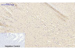 anti-Transforming Growth Factor, beta 1 (TGFB1) (AA 310-390) antibody