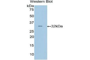 Western blot analysis of the recombinant protein. (GRAP2 Antikörper  (AA 20-262))