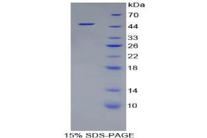 SDS-PAGE analysis of Rat FABP6 Protein. (FABP6 Protein)