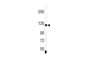 Western blot analysis of anti-Vinculin Antibody (C-term) (ABIN391626 and ABIN2841546) in mouse lung tissue lysates (35 μg/lane). (Vinculin Antikörper  (C-Term))