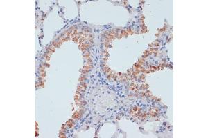 Immunohistochemistry of paraffin-embedded rat liver using SLC39 antibody (ABIN1682781, ABIN3017803, ABIN3017805 and ABIN6220263) at dilution of 1:100 (40x lens). (SLC39A4 Antikörper  (AA 23-327))