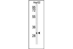 Western Blotting (WB) image for anti-Deiodinase, Iodothyronine, Type III (DIO3) (AA 249-278), (C-Term) antibody (ABIN951914)