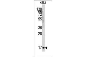 Image no. 1 for anti-Microsomal Glutathione S-Transferase 1 (MGST1) (Center) antibody (ABIN357900) (MGST1 Antikörper  (Center))