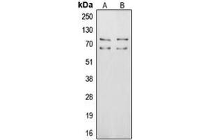 Western blot analysis of Vitronectin expression in MCF7 (A), HepG2 (B) whole cell lysates. (Vitronectin Antikörper  (Center))