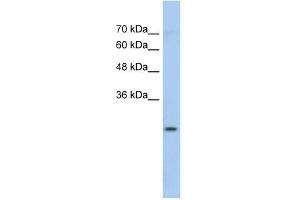 GSTM1 antibody used at 1 ug/ml to detect target protein. (GSTM1 Antikörper  (N-Term))