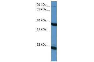 Pleiotrophin antibody used at 1 ug/ml to detect target protein. (Pleiotrophin Antikörper)