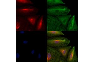 ABIN6259273 and ABIN6273655 staining  cells by IF/ICC. (FIL1h Antikörper  (C-Term))