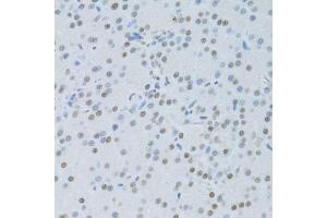 Immunohistochemistry of paraffin-embedded rat pancreas using SNRNP70 antibody. (SNRNP70 Antikörper  (AA 150-250))