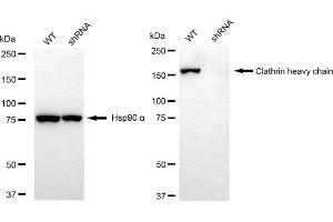 Western blotting analysis using Clathrin heavy chain antibody (ABIN7798090).