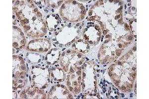 Immunohistochemical staining of paraffin-embedded liver tissue using anti-LIPG mouse monoclonal antibody. (LIPG Antikörper)