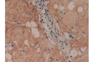 Immunohistochemistry (IHC) image for anti-Collagen, Type I, alpha 1 (COL1A1) (AA 253-471) antibody (ABIN7443395)