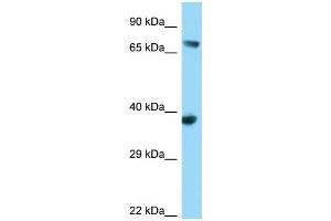 WB Suggested Anti-FYB Antibody Titration: 1.