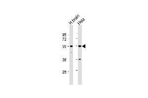 All lanes : Anti-TFG Antibody (Center) at 1:1000 dilution Lane 1: human brain lysate Lane 2: Hela whole cell lysate Lysates/proteins at 20 μg per lane. (TFG Antikörper  (AA 85-114))