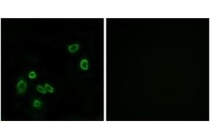 Immunofluorescence analysis of A549 cells, using BRP44L Antibody.