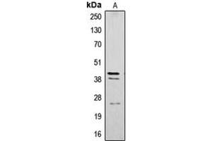 Western blot analysis of Cathepsin B expression in SW480 (A) whole cell lysates. (Cathepsin B Antikörper  (Center))