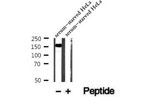 Western blot analysis of extracts of serum-starved HeLa cells, using Phospho-AS160 (Ser588) Antibody.
