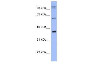 KCTD4 antibody used at 1 ug/ml to detect target protein. (KCTD4 Antikörper  (N-Term))
