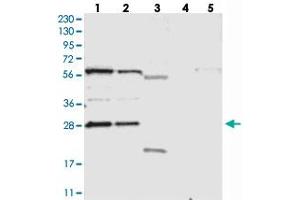 Western blot analysis of Lane 1: RT-4, Lane 2: U-251 MG, Lane 3: Human Plasma, Lane 4: Liver, Lane 5: Tonsil with PHOSPHO2 polyclonal antibody  at 1:250-1:500 dilution.