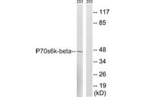 Western blot analysis of extracts from 293 cells, using p70 S6 Kinase beta (Ab-423) Antibody. (RPS6KB2 Antikörper  (AA 389-438))