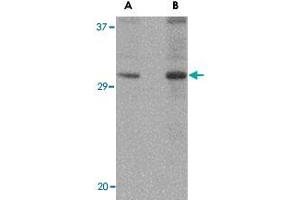 Western blot analysis of DNAL1 in NIH/3T3 cell lysate with DNAL1 polyclonal antibody  at (A) 1 and (B) 2 ug/mL . (DNAL1 Antikörper  (C-Term))