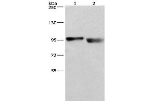 Western Blot analysis of A431 and lovo cell using KIAA1524 Polyclonal Antibody at dilution of 1:597